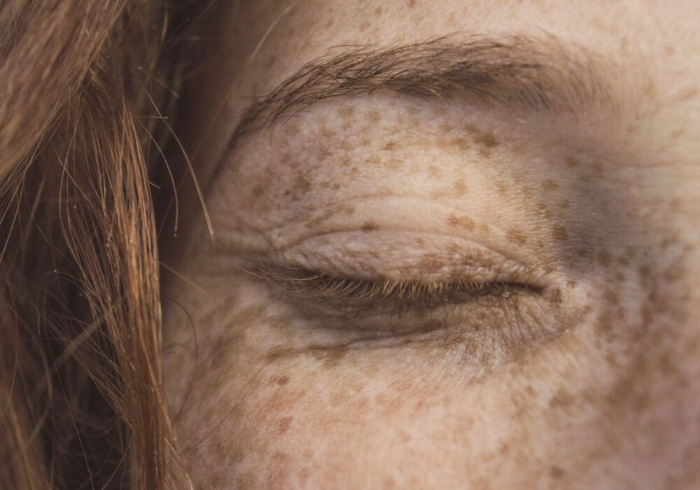 Professional pigmentation assessment consultation